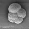 Immagine al microscopio elettronico a scansione di un foraminifero (microrganismo marino a guscio calcareo)
